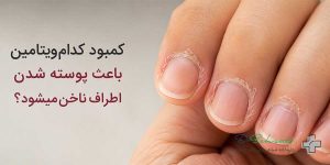 کمبود کدام ویتامین باعث پوسته شدن اطراف ناخن میشود